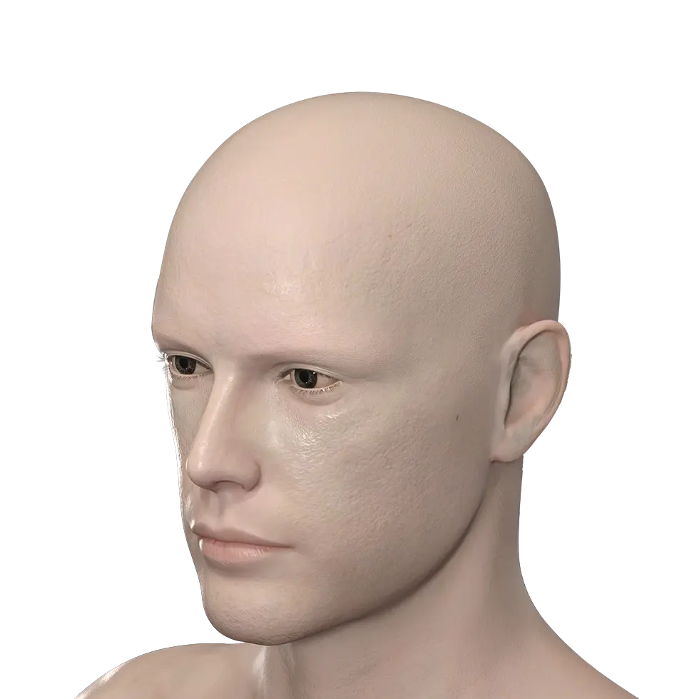 Alopecia Universale studio Heka Napoli
